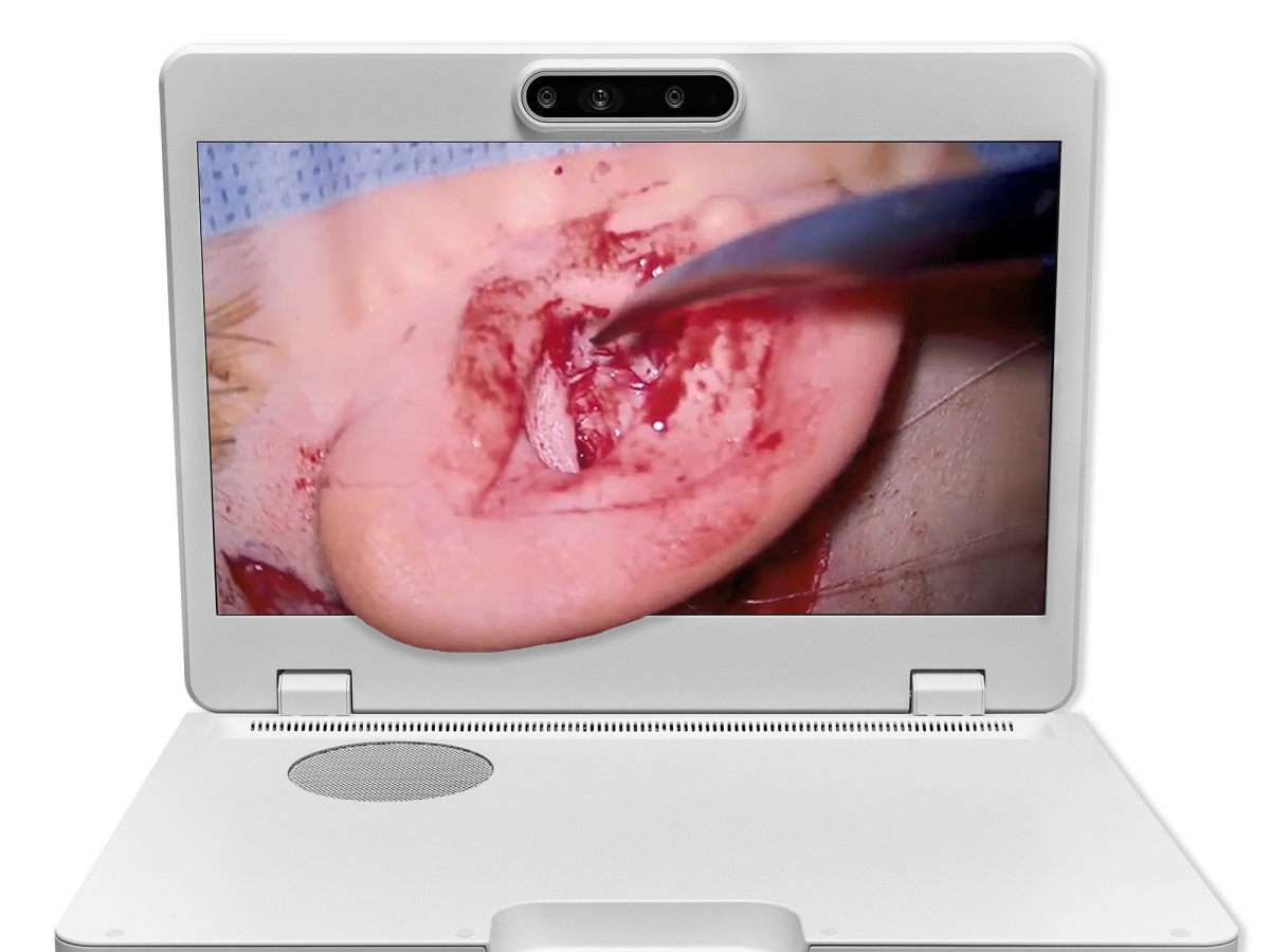 达擎之＂Heads-up 3D显微手术显示系统＂，整合4K裸眼3D显示及眼球追踪系统，具备快速追踪人眼移动位置功能，减轻医师长时间维持固定姿势的负担，让医师能有更宽广清晰的3D立体视野及更舒适的姿势来执行手术。